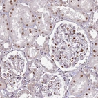 Immunohistochemical staining of human kidney shows strong nuclear positivity in cells in tubules and cells in glomeruli.
