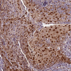 Anti-KPNA4 Antibody