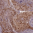 Immunohistochemical staining of human tonsil shows strong nuclear-cytoplasmic positivity in squamous epithelial cells.