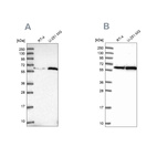 Western blot analysis using Anti-KPNA4 antibody HPA045500 (A) shows similar pattern to independent antibody HPA043154 (B).