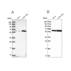 Western blot analysis using Anti-KPNA4 antibody HPA045500 (A) shows similar pattern to independent antibody HPA043154 (B).