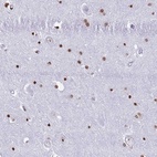 Anti-RYK Antibody