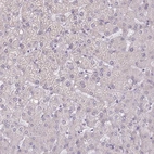 Immunohistochemical staining of human liver shows low expression as expected.