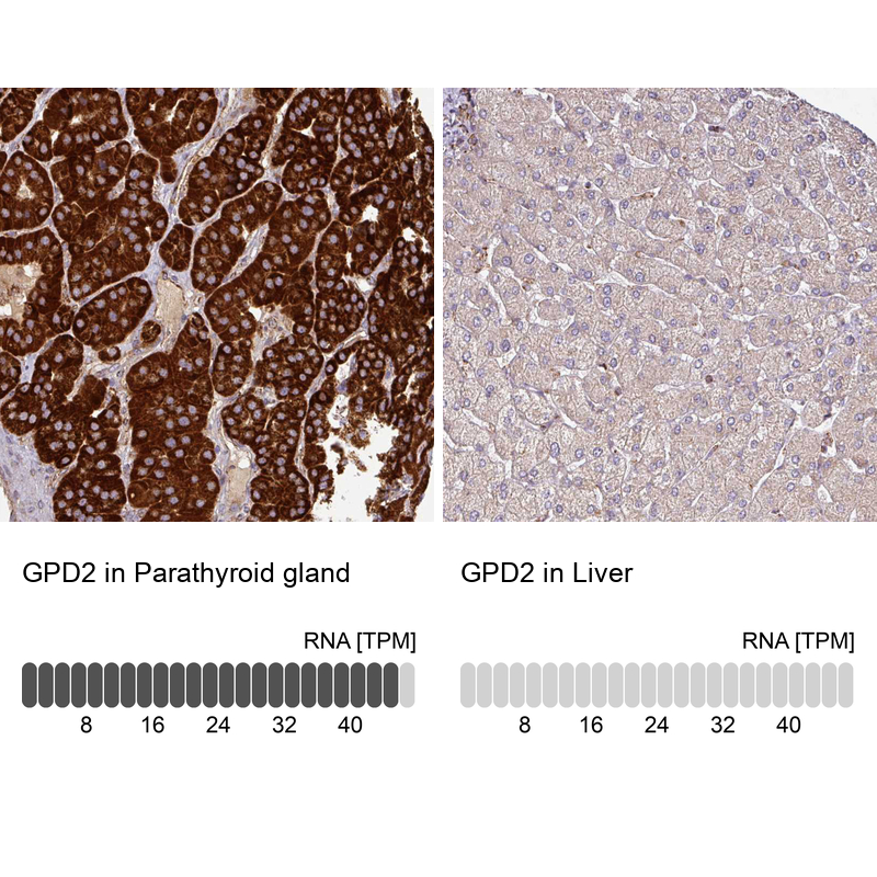 Anti-GPD2 Antibody