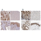 Immunohistochemical staining of human gastrointestinal, liver, prostate and squamous epithelia using Anti-GPD2 antibody HPA045506 (A) shows similar protein distribution across tissues to independent antibody HPA008012 (B).
