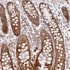Immunohistochemical staining of human colon shows strong cytoplasmic granular positivity in glandular cells.