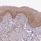 Immunohistochemical staining of human skin shows strong cytoplasmic granular positivity in squamous epithelial cells.