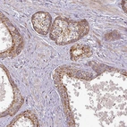 Immunohistochemical staining of human prostate shows strong cytoplasmic granular positivity in glandular cells.