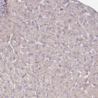 Immunohistochemical staining of human liver shows negative to very weak cytoplasmic granular positivity in hepatocytes.