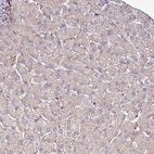 Immunohistochemical staining of human liver shows negative to very weak cytoplasmic granular positivity in hepatocytes.