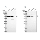 Western blot analysis using Anti-GPD2 antibody HPA045506 (A) shows similar pattern to independent antibody HPA008012 (B).