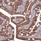 Anti-MICU2 Antibody