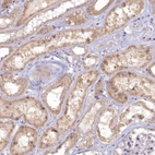 Immunohistochemical staining of human kidney shows moderate cytoplasmic positivity in cells in tubules.
