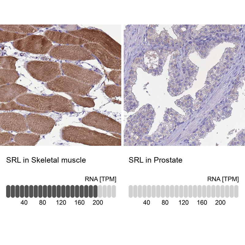 Anti-SRL Antibody