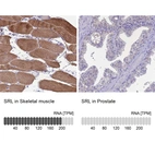 Anti-SRL Antibody