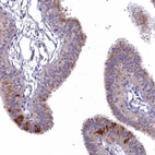 Immunohistochemical staining of human fallopian tube shows strong cytoplasmic granular positivity in glandular cells.