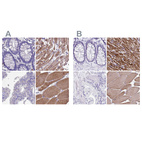 Immunohistochemical staining of human colon, heart muscle, prostate and skeletal muscle using Anti-SRL antibody HPA045520 (A) shows similar protein distribution across tissues to independent antibody HPA041535 (B).