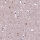 Immunohistochemical staining of human cerebral cortex shows moderate cytoplasmic granular positivity in neurons.
