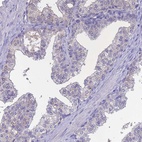 Immunohistochemical staining of human prostate shows low expression as expected.