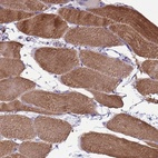 Immunohistochemical staining of human skeletal muscle shows high expression.