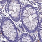 Immunohistochemical staining of human colon using Anti-SRL antibody HPA045520.