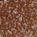 Anti-NXNL2 Antibody