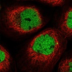 Immunofluorescent staining of human cell line A-431 shows localization to nucleoplasm.