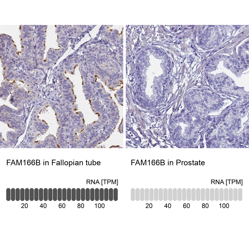 Anti-FAM166B Antibody