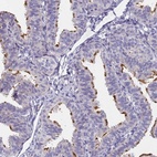 Immunohistochemical staining of human fallopian tube shows high expression.