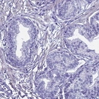 Immunohistochemical staining of human prostate shows low expression as expected.