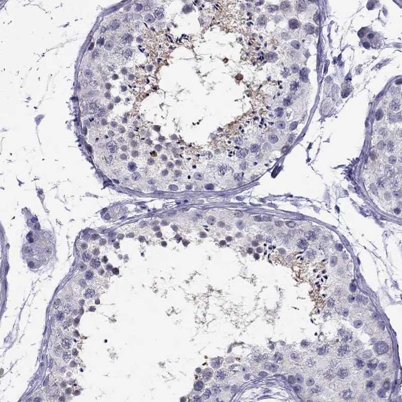 Anti-CHRNB3 Antibody