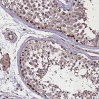 Anti-MCRIP1 Antibody