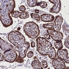 Immunohistochemical staining of human placenta shows strong cytoplasmic positivity in trophoblastic cells.
