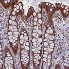 Immunohistochemical staining of human rectum shows strong cytoplasmic positivity in glandular cells.