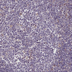 Immunohistochemical staining of human tonsil shows no cytoplasmic positivity in germinal center cells as expected.