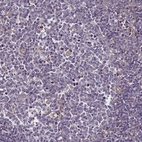 Immunohistochemical staining of human tonsil shows no cytoplasmic positivity in germinal center cells as expected.