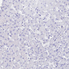 Immunohistochemical staining of human liver shows no positivity in hepatocytes as expected.