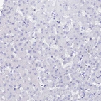 Immunohistochemical staining of human liver shows no positivity in hepatocytes as expected.