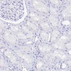 Immunohistochemical staining of human kidney shows no positivity in cells in tubules as expected.