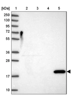 Lane 1: Marker [kDa] 250, 130, 95, 72, 55, 36, 28, 17, 10_br/_Lane 2: Human cell line RT-4_br/_Lane 3: Human cell line U-251MG sp_br/_Lane 4: Human plasma (IgG/HSA depleted)_br/_Lane 5: Human liver tissue