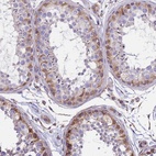 Anti-TCEAL5 Antibody