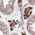 Anti-OR14J1 Antibody