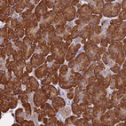 Anti-CCT6A Antibody