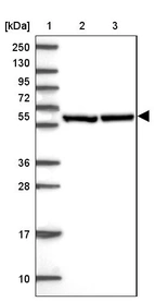 Lane 1: Marker [kDa] 250, 130, 95, 72, 55, 36, 28, 17, 10_br/_Lane 2: Human cell line RT-4_br/_Lane 3: Human cell line U-251 MG