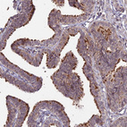 Immunohistochemical staining of human fallopian tube shows moderate cytoplasmic positivity in glandular cells.