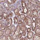 Immunohistochemical staining of human kidney shows moderate cytoplasmic positivity in cells in tubules.