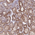 Immunohistochemical staining of human kidney shows moderate cytoplasmic positivity in cells in tubules.
