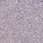 Immunohistochemical staining of human pancreas shows no positivity in exocrine glandular cells as expected.