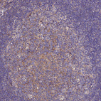 Immunohistochemical staining of human tonsil shows moderate cytoplasmic positivity in germinal center cells.
