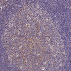 Immunohistochemical staining of human tonsil shows moderate cytoplasmic positivity in germinal center cells.